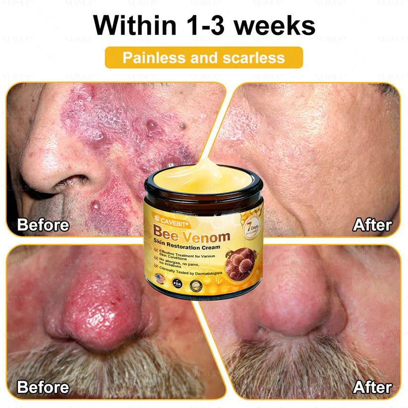💐💟💐Made and Shipped from US ✨ Cavebit® Bee Venom Skin Restoration Cream 🔥 LAST DAY 80% OFF