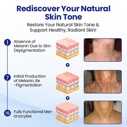 Cavebit® Skin Pigment Restoring Spray - 100% Natural & Steroid-Free