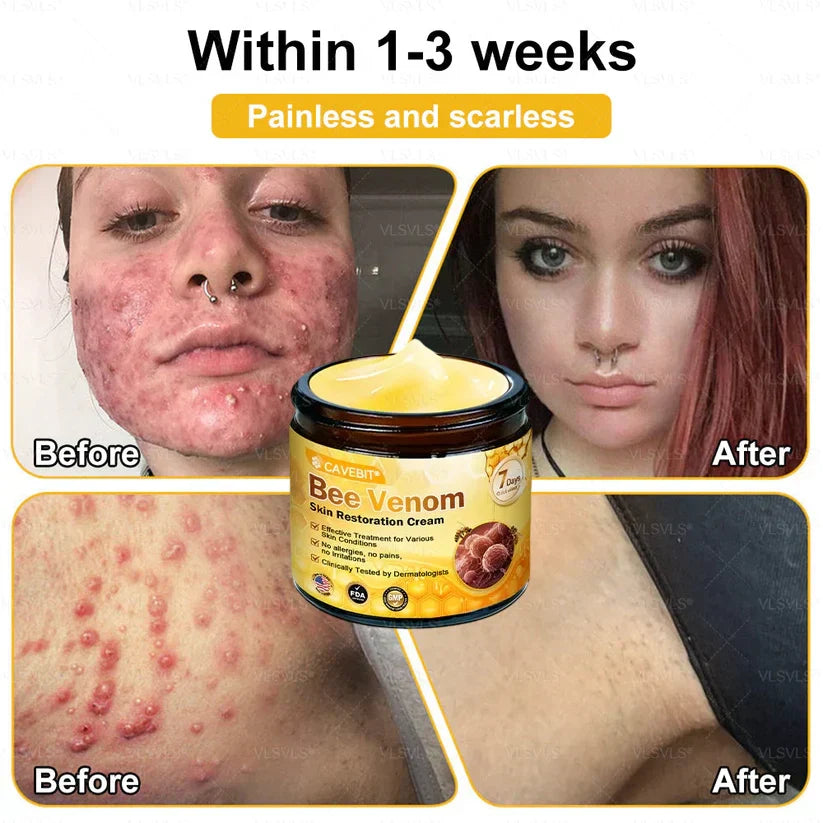 💐💟💐Made and Shipped from US ✨ Cavebit® Bee Venom Skin Restoration Cream 🔥 LAST DAY 80% OFF