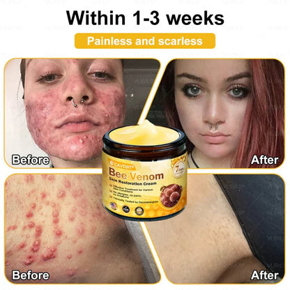 💐💟💐Made and Shipped from US ✨ Cavebit® Bee Venom Skin Restoration Cream 🔥 LAST DAY 80% OFF