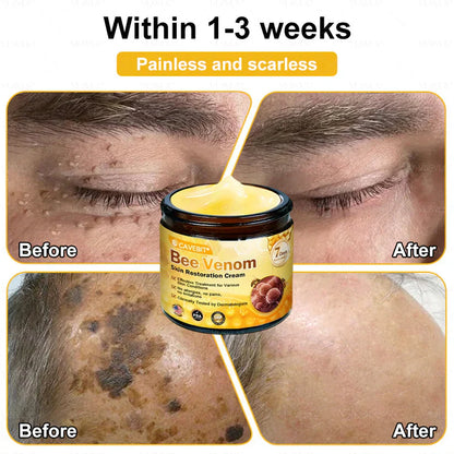 💐💟💐Made and Shipped from US ✨ Cavebit® Bee Venom Skin Restoration Cream 🔥 LAST DAY 80% OFF