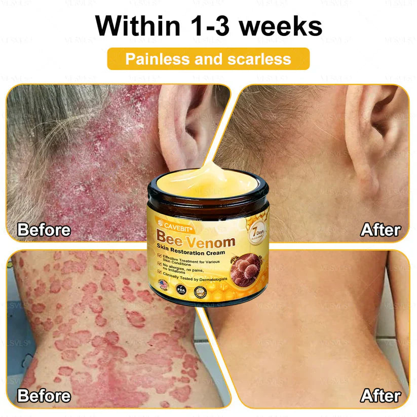 💐💟💐Made and Shipped from US ✨ Cavebit® Bee Venom Skin Restoration Cream 🔥 LAST DAY 80% OFF