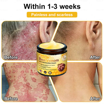 💐💟💐Made and Shipped from US ✨ Cavebit® Bee Venom Skin Restoration Cream 🔥 LAST DAY 80% OFF