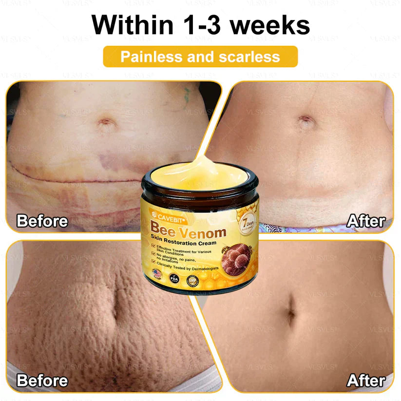 💐💟💐Made and Shipped from US ✨ Cavebit® Bee Venom Skin Restoration Cream 🔥 LAST DAY 80% OFF