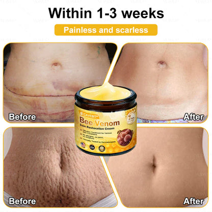 💐💟💐Made and Shipped from US ✨ Cavebit® Bee Venom Skin Restoration Cream 🔥 LAST DAY 80% OFF